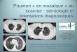 Poumon « en mosaïque » au scanner : sémiologie et ...pe.sfrnet.org/Data/ModuleConsultationPoster/pdf/2011/1/cd409e3d-a0... · - Dilatation des bronches - Perfusion en mosaïque