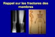 Rappel sur les fractures des membres - imedical.fr · Une fracture du fémur avec une cuisse qui présente une angulation ou un important chevauchement, ... circulaire pour fracture