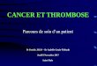 CANCER ET THROMBOSE - oncobretagne.fr · Cancer et maladie veineuse thromboembolique 1) ... La MVTE est un marqueur diagnostique de cancer Rechercher le cancer occulte surtout si