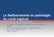La radioanatomie et pathologie du canal inguinalpe.sfrnet.org/Data/ModuleConsultationPoster/pdf/2011/1/6e3ae77e-5f... · •Un syndrome de masse à ce niveau est souvent dû à une