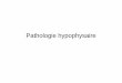 pathologie hypophysaire 2016 [Mode de compatibilité] · métastases, les méningiomes et les anévrysmes (de ... -les autres causes maladies inflammatoires avec granulomes, la chirurgie,