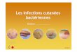 Les infections cutanées bactériennes - at.om.free.frat.om.free.fr/Files/infections_cutanees_bacteriennes_1.pdf · 1 000 000 bactéries/cm ... Sommaire Les incontournables Classification