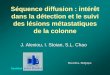 Séquence diffusion : intérêt dans la détection et le ...pe.sfrnet.org/Data/ModuleConsultationPoster/pdf/2011/1/a2e619af-8... · dans la détection et le suivi des lésions métastatiques