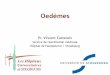 Oedèmes - DFGSM3 - 2017reamed-htp.org/wp-content/uploads/2017/03/Oedèmes-DFGSM3-2017.… · H 2 O. Castelain V. / Février 2017 Oedèmes / DFGSM3 Pression oncotique H 2 O Physiopathologie