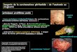 imagerie de la carcinomatose péritonéale : de …onclepaul.fr/wp-content/uploads/2011/07/carcinomatoses... · atteinte du lit capillaire et développement ... aurait pu avoir une