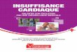 INSUFFISANCE CARDIAQUE - Fédération Française … · systolique (PAS) ; c’est la pression qui règne dans les artères à chaque contraction du cœur. Le second est la pression