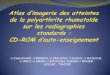 H ZAGHOUANI, A BERRICH, H ZEGLAOUI, T …pe.sfrnet.org/Data/ModuleConsultationPoster/pdf/2011/1/e441f376-ba... · DEFINITION La polyarthrite rhumatoïde (PR) : Le plus fréquent des