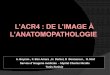 L’ACR4 : DE L’IMAGE À L’ANATOMOPATHOLOGIEpe.sfrnet.org/Data/ModuleConsultationPoster/pdf/2013/1/805ed5cd... · glandulaire du sein droit ACR4 . ... associées à des lésions