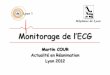 monitorage de l'ECG - jivd-france.com · Fréquence cardiaque Rythme de base 2012 ... -> Troubles du rythme ventriculaire +++ ... monitorage de l'ECG.ppt Author: