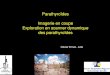 Parathyroïdes Imagerie en coupe Exploration en …cireol.net/wp-content/uploads/2017/05/Imagerie-TDM-parathyroides... · Adénome parathyroïdien gauche ectopique sous mandibulaire
