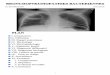 PLANuniv.ency-education.com/uploads/1/3/1/0/...2016_bronchopneumopath… · Les broncho pneumopathies sont des infections des voies respiratoires basses. Elles recouvrent les bronchites,