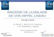 Imagerie de la maladie de von hippel lindau - pe.sfrnet.orgpe.sfrnet.org/Data/ModuleConsultationPoster/pdf/2013/1/b72486b7... · IMAGERIE DE LA MALADIE DE VON HIPPEL-LINDAU Georges