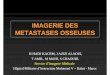 IMAGERIE DES METASTASES OSSEUSES - pe.sfrnet.orgpe.sfrnet.org/Data/ModuleConsultationPoster/pdf/2009/1/37757dd8-c... · Le but de l’imagerie: - Caractérisation des lésions (nombre,