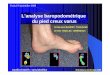 L’analyse baropodométrique du pied creux varus · P= F/S) Novel Médicapteur force Mesure de pression sur chaque capteur. Analyse baropodométrique du pied creux varus Entretiens