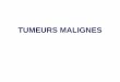 CLASSIFICATION DES TUMEURS MALIGNES - …medecine.ups-tlse.fr/dcem1/anapath/tp/TP_TUMEURS_MALIGN...Le carcinome in situ est aussi dit « non invasif » En pratique Les termes de dysplasie