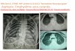 Mlle Serra S..27ANS .AVP survenu le 31/3/13. Traumatisme ... · • · Hémothorax massif • · Contusion myocardique Mortalité tardive (lésions « occultes » • Tamponnade •
