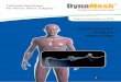 Expert Technologies in PVDF · Instrument chirurgical d 5 cm REF IST03F1 UV = 1 kit (g + d) DynaMesh®-IST01 Instrument chirurgical d 6 cm REF IST01F1 UV = 1 kit (g + d) DynaMesh®-IST02