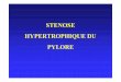 stenose du pylore - Epu B AMIENS(FRANCE) du pylore.pdf · • Hypertrophie progressive des fibres musculaires du pylore • Cause chirurgicale la plus fréquente de vomissements chroniques