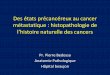 Des états précancéreux au cancer métastatique : histopathologie demoodle.sorbonne-paris-cite.fr/pluginfile.php/14940/mod... · 2016-10-24 · • Carcinome In Situ (CIS) : prolifération