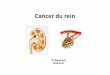 Cancer du rein - الموقع الأول للدراسة في الجزائرuniv.ency-education.com/uploads/1/3/1/0/13102001/uro5an...TDM Examen essentiel pour le diagnostic et le bilan