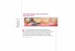 Partie 3 - edimark.fr · miologie es lsions gingivales Images en Dermatologie • Vol. IX - n° 2 • mars-avril 2016 62 tlas Lésions primaires surélevées liquidiennes Vésicule