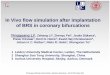 In Vivo flow simulation after implantation of BRS in coronary … · 2016-11-18 · In Vivo flow simulation after implantation of BRS in coronary bifurcations Yingguang Li1, Zehang