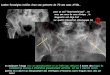Lombo-fessalgies isolées chez une patiente de 70 …onclepaul.net/wp-content/uploads/2011/07/osFILEminimizer...Lombo-fessalgies isolées chez une patiente de 70 ans sans ATCD… pour
