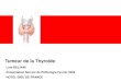 Tumeur de la Thyroïde - epathologies · 2008-03-05 · –Une glande endocrine, lobulée. –Située dans la région cervicale devant les cordes vocales et le larynx, en avant de