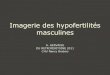 Imagerie des hypofertilités masculinesonclepaul.net/wp-content/uploads/2011/07/DU... · 2012-12-31 · • Biochimie séminale •– Phosphatases acides, citrate, zinc : prostate