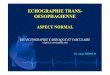 ECHOGRAPHIE TRANS- OESOPHAGIENNEechocardio.med.free.fr/Nimes Nov08/ETO 08 Dr HIDDOUD.pdf · 2009-06-09 · •Inexpérience cause la plus fréquente d’echec (3,9 % si < 200 ETO