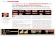 CLINIC Incidence de la prothèse fixée tissus parodontaux · 28 < LE FIL DENTAIRE < N°61 < Mars 2011 CLINIC STEP BY STEP Incidence de la prothèse fixée sur les tissus parodontaux: