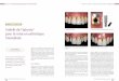 3E LAURÉAT 2019 Intérêt de l’iphysio Vue initiale du …...2020/01/03  · pulpe vivante, la dent subit une perte hydrique des tissus dentinaires ainsi que des modiﬁ cations