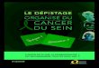 organisé du cancer - Nouvelle-Aquitaine · Le cancer du sein est le cancer le plus fréquent chez la femme. il est aussi le plus meurtrier. chaque année, ce sont près de 49 000
