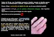 Onychomadèse - ONCLE PAULonclepaul.net/wp-content/uploads/2011/07/crocaFILEminimizer1.pdfExamen histologique d’un polype du colon sigmoïde: dilatation kystique des glandes et des