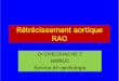 Rétrécissement aortique RAOuniv.ency-education.com/uploads/1/3/1/0/13102001/cardio4... · 2018-02-07 · RAO paradoxal • • • • • RAO avec surface aortique sérré