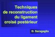 Techniques de reconstruction du ligament croisé postérieurTechniques de reconstruction • Technique avec contrôle arthroscopique • Technique par arthrotomie-En un temps -En 2