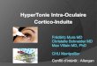 HyperTonie Intra-Oculaire Cortico-Induitejournee-montpellieraine-ophtalmologie.fr/files/137/COMM/...50 mg per os prednisone 5 ng/ml 12 ng/ml 60 ng/ml 5 mg péribulbaire dexaméthasone