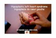 Hypoplastic left heart syndrome Hypoplasie du cœur gauche · 95% mortalité pendant le 1er mois 80% mortalité pendant la 1ère semaine ... 87.3 27 63.0 42.4 - 80.6 < 0.001 First