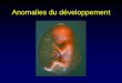 Anomalies du développement · Anomalies du développement Les troubles du développement prénatal engendrent des malformations congénitaleset constituent une cause importante de