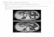 CERF 2018 - Module Urgences urgence-abdomen-2018-TAOUREL ... · Douleur lombaire et fébricule chez un homme de 50 ans sans antécédent particulier. L’échographie rénale ne retrouve