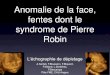 Anomalie de la face, fentes dont le syndrome de Pierre Robin · labio-palatine (Q370) Total Naissances Age=0 Age < 1 an Incidence / 10 000 N Nantes Angers Total Incidence / 10 000