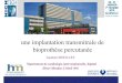 une implantation transmitrale de bioprothèse percutanéehightech-cardio.org/usrfile/Presentation/2019/S9-IN049.pdf · Histoire de la maladie Angioplastie CD2 sur SCA en Mars 2016