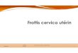 AHFMC Frottis Cervico Utérin -Docteur Sylvie SOTTER 1...CAT devant une femme ayant une cytologie CU anormale Recommandations INCA 12/2016 3,9% FCU anormaux: 235 000 patientes, 31