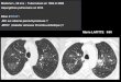 Marie LAFITTE IHN - ONCLE PAULonclepaul.fr/wp-content/uploads/2011/07/cpcpe.pdf · 2015. 9. 8. · CAT devant un parenchyme en mosaïque Asthme/BPCO Bronchiolite oblitérante : Infections