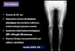 Cas clinique - ONCLE PAULonclepaul.fr/wp-content/uploads/2011/07/erch.pdfScintigraphie osseuse 99mTc diphosphonates Hyperfixation intense métaphyso-diaphysaire bilatérale et symétrique