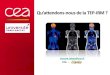 Qu’attendons-nous de la TEP-IRM · 2016. 12. 7. · 1. Constitution d’un atlas IRM T1-TDM sur Nsujets sains 2. Pour chaque patient : - recalage élastique des NIRM T1 su l’IRM