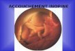 ACCOUCHEMENT INOPINEsecours-montagne.fr/IMG/pdf/accouche.pdf · 2008. 12. 4. · Procidence du cordon • Le cordon ombilical sort avant la tête du fœtus et est perçu comme une
