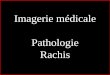 Imagerie médicale Pathologie Rachis