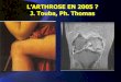 L’ARTHROSE EN 2005 ? J. Touba, Ph. Thomas