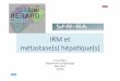 IRM et métastase(s) hépaque(s)